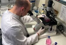 الدنمارك تعتزم توفير لقاحات لمخالطي مرضى جدري القرود