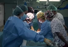 نجاح أول عملية زراعة أمعاء في العالم لطفلة إسبانية
